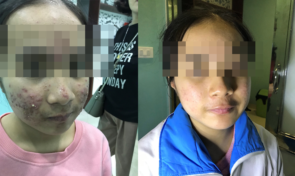 Phan Huyền Nga - 14 tuổi - Phường Ngọc Trạo - TP Thanh Hóa